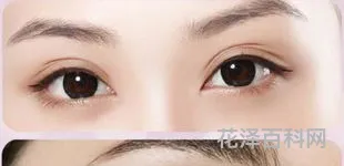 消除川字纹最好的方法 怎么去川字纹小妙招