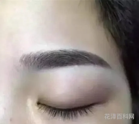 眉毛稀少怎么办 眉毛稀少是什么原因
