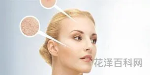 自制祛斑小妙招 自己在家如何祛斑