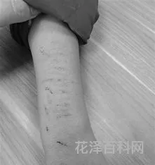 伤痕累累怎么读 伤痕累累和果实累累的读音