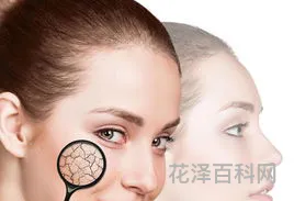 秋季皮肤干燥