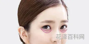 去眼袋的方法，怎么改善眼袋