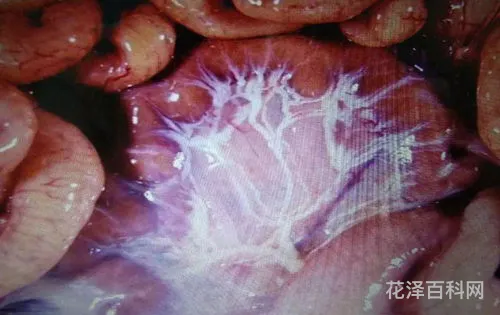 大肠杆菌是什么，大肠杆菌一般是哪里来的