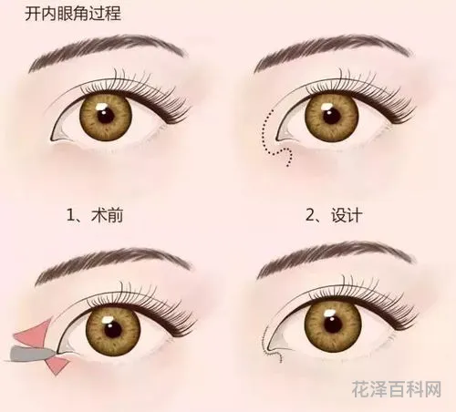 眼睛怎么样变大，眼睛自然变大的方法