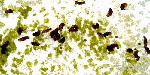 水仙花和水熊虫 巨型水熊虫
