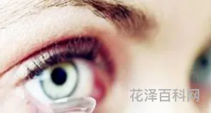 美瞳对眼睛的危害 美瞳正常价位